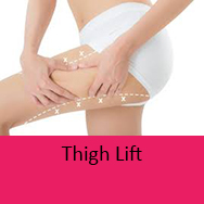 thigh lift